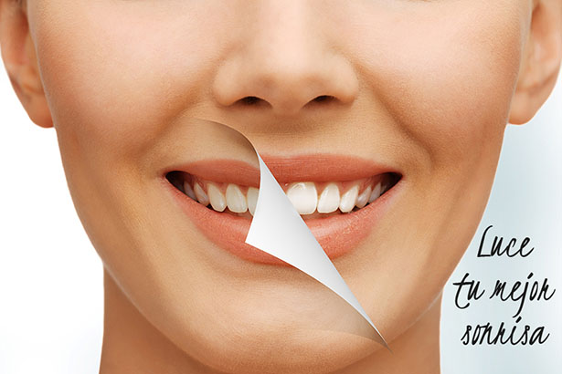 Estética dental descripción