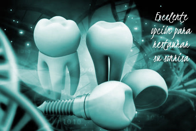 implantes descripción